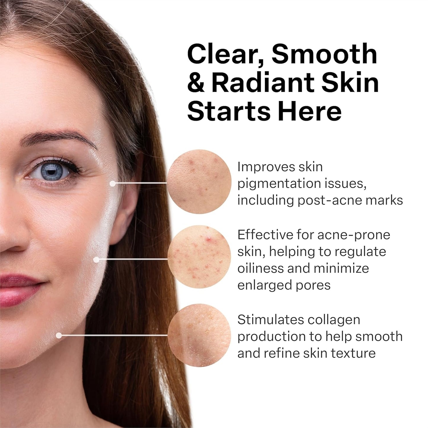 A313 French Pharmacy Vitamin A (Retinoids) Lightweight Face Cream for Anti-Aging, Reduce Wrinkles, Prevents Acne Breakouts, and Hyperpigmentation - Skincare for Smooth, Radiant Skin - 50g Cream